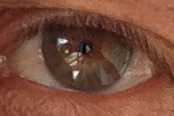 eye photo